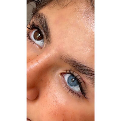 لنز آبی دور تیله ای پیکسی بلو گلوریا