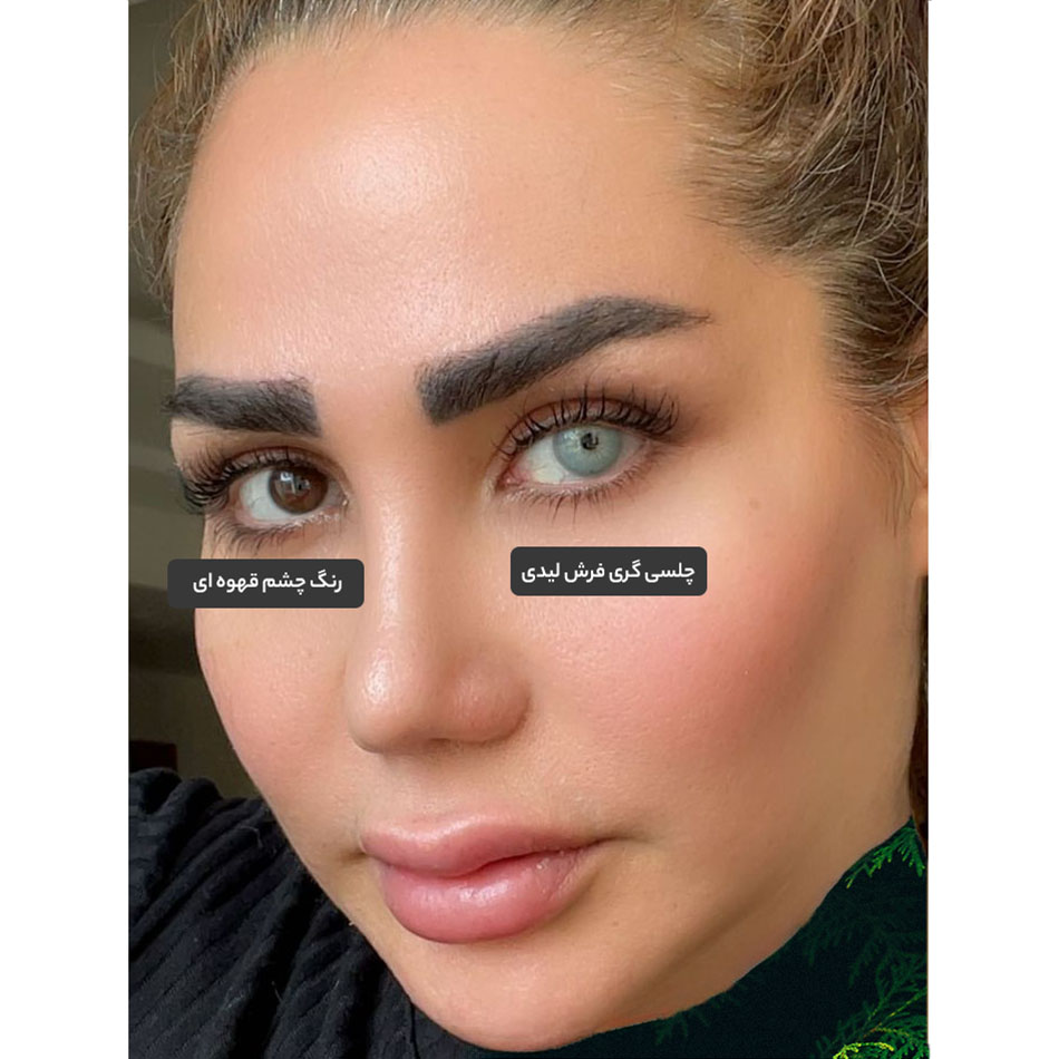 chelsea-gray-freshlady-03 لنز طوسی آیس با ته مایه سبز آبی چلسی گری فرش لیدی