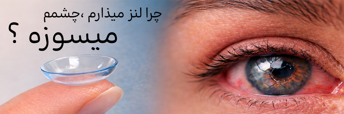لنز میذارم چشمم میسوزه، چیکار کنم؟