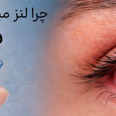 لنز میذارم چشمم میسوزه، چیکار کنم؟